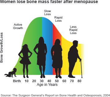 Women lose bone mass faster after menopause